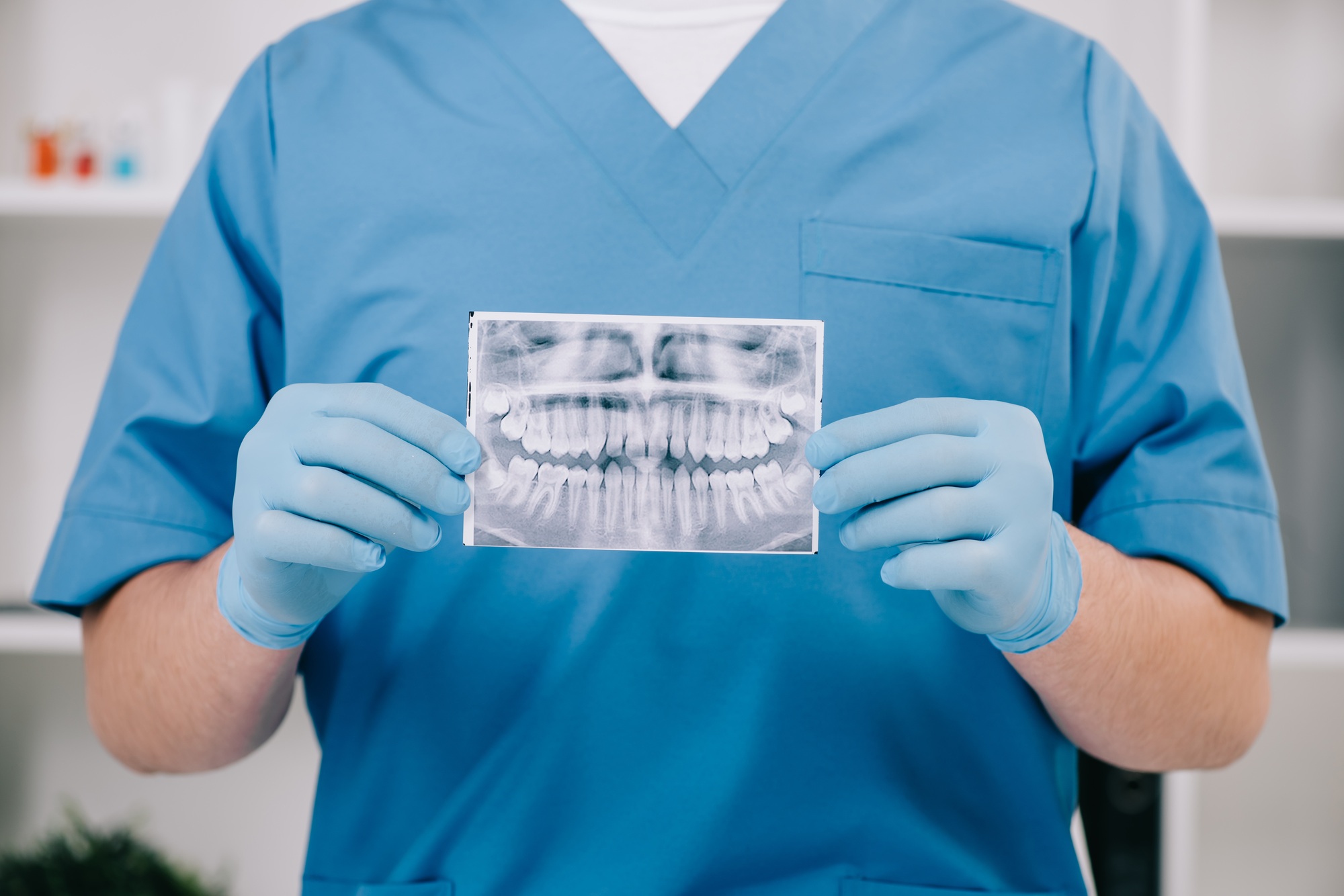 cropped view of orthodontist holding teeth x-ray in clinic