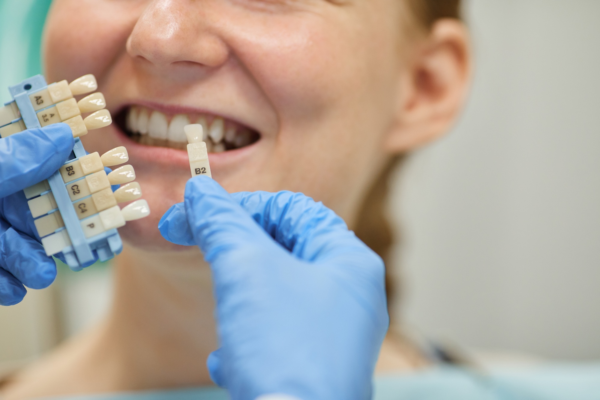 The Dental Implant Process
