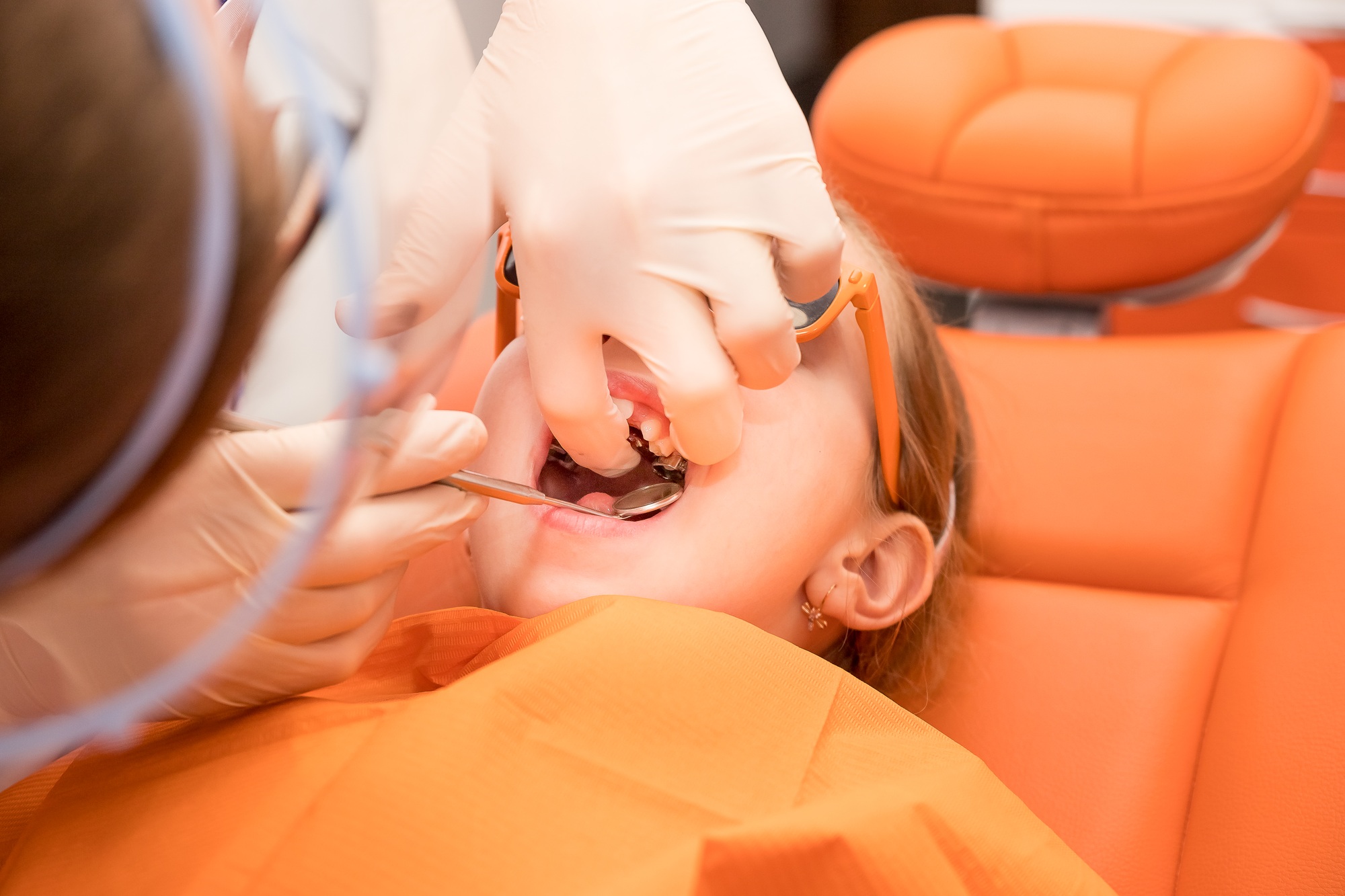 Dental plate. Expansion of the jaw in a child. teenage girl holding an orthodontic plate in her