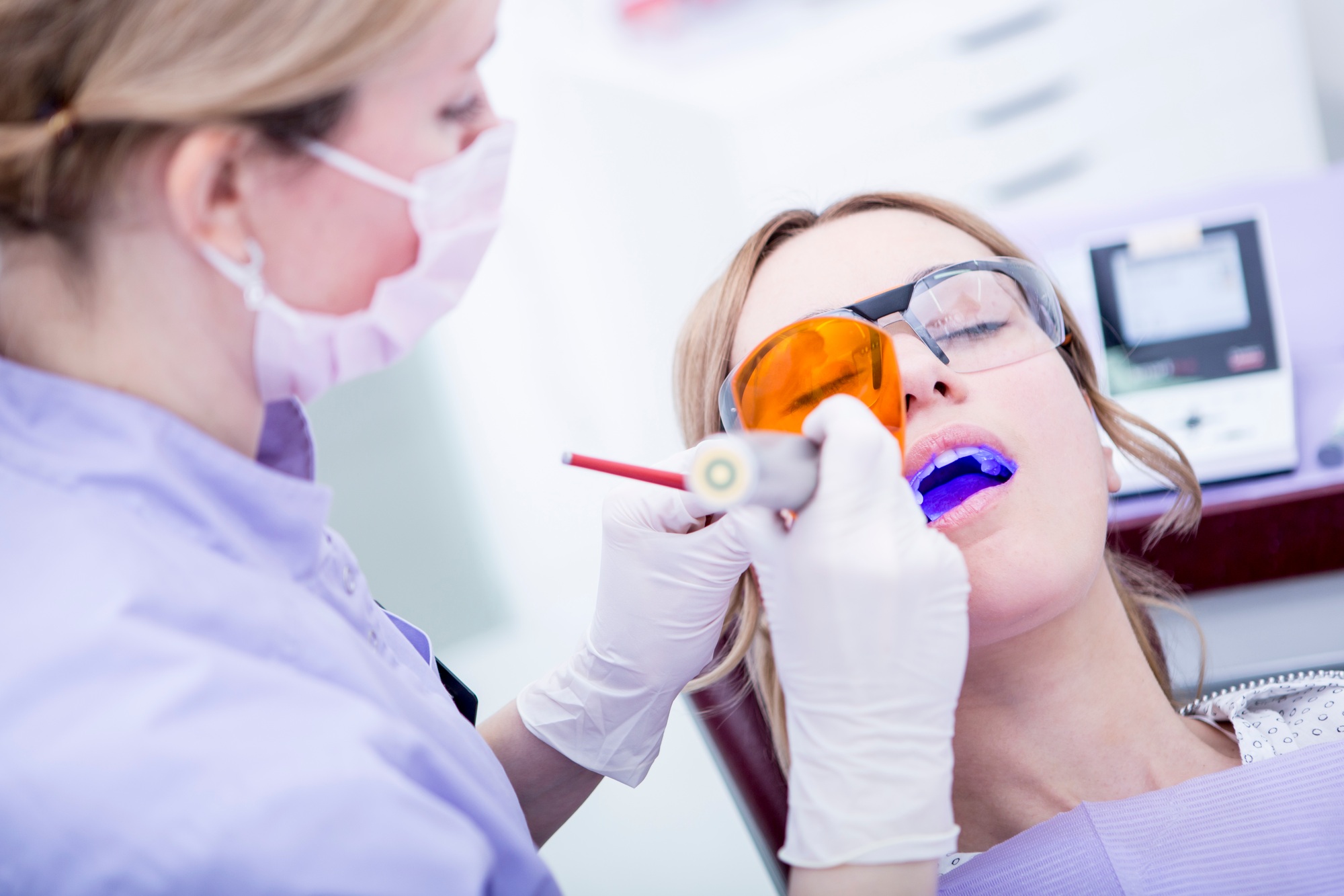 Hardening of dental filling at the dentist