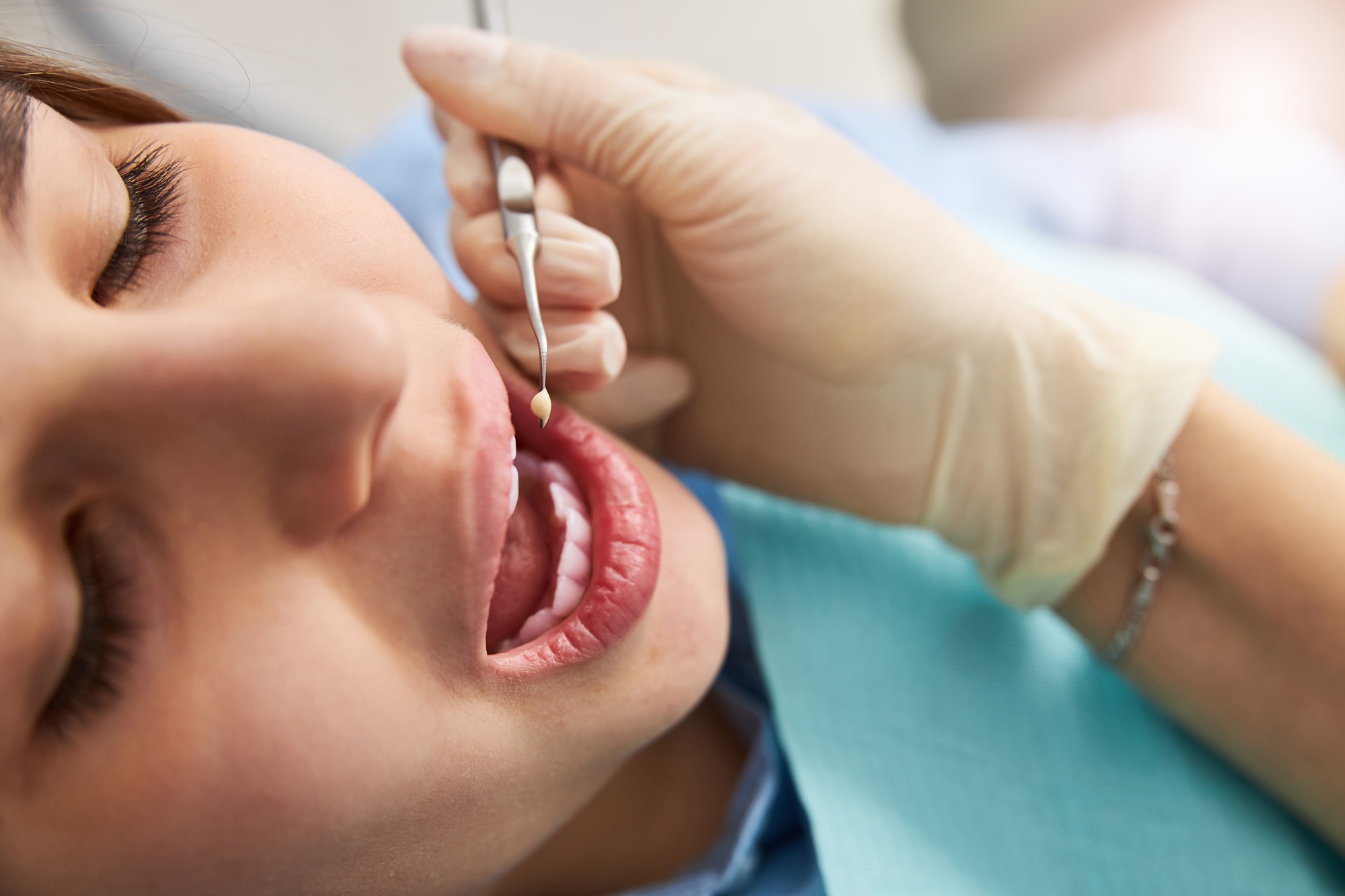 Patient with opened mouth ready for dental restoration with plugger