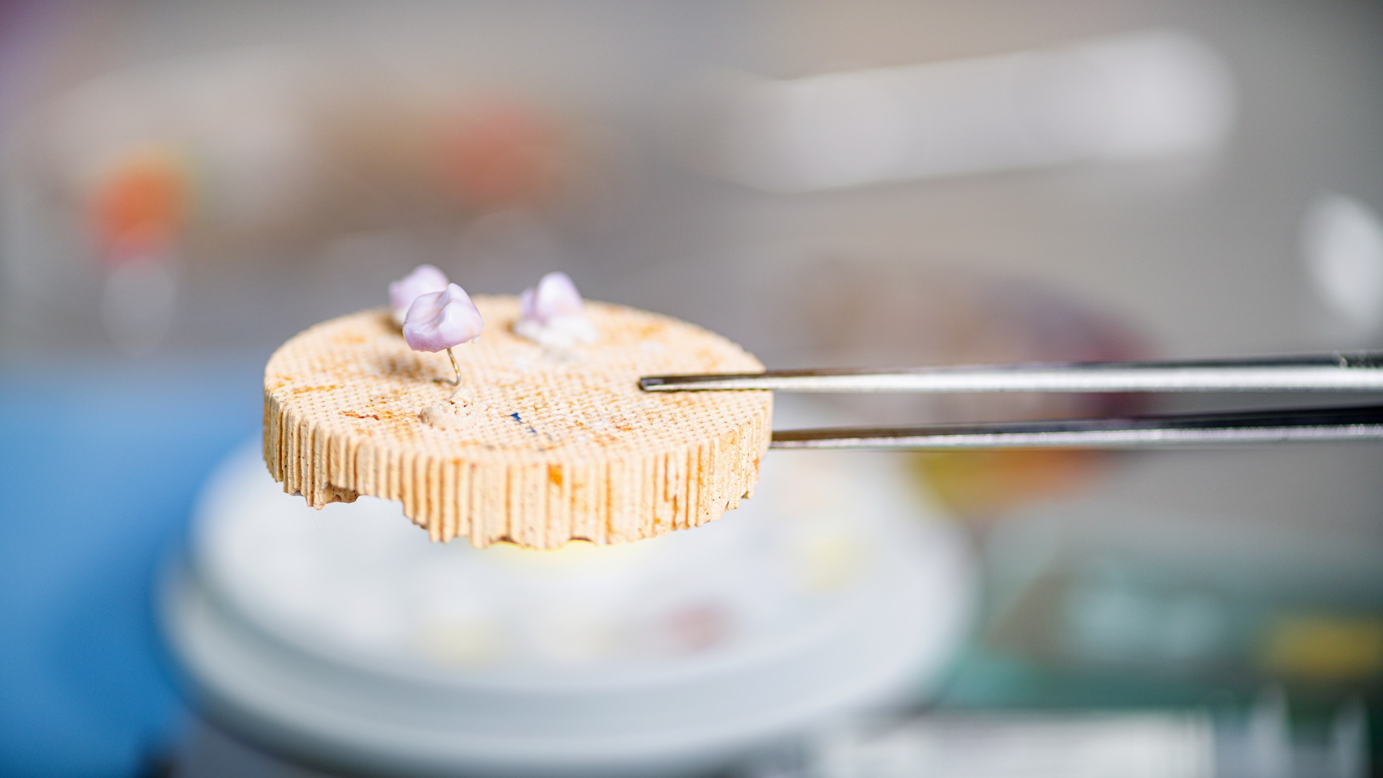 Teeth Prosthodontics. Teeth Crowns Prepared for Oven and Press.