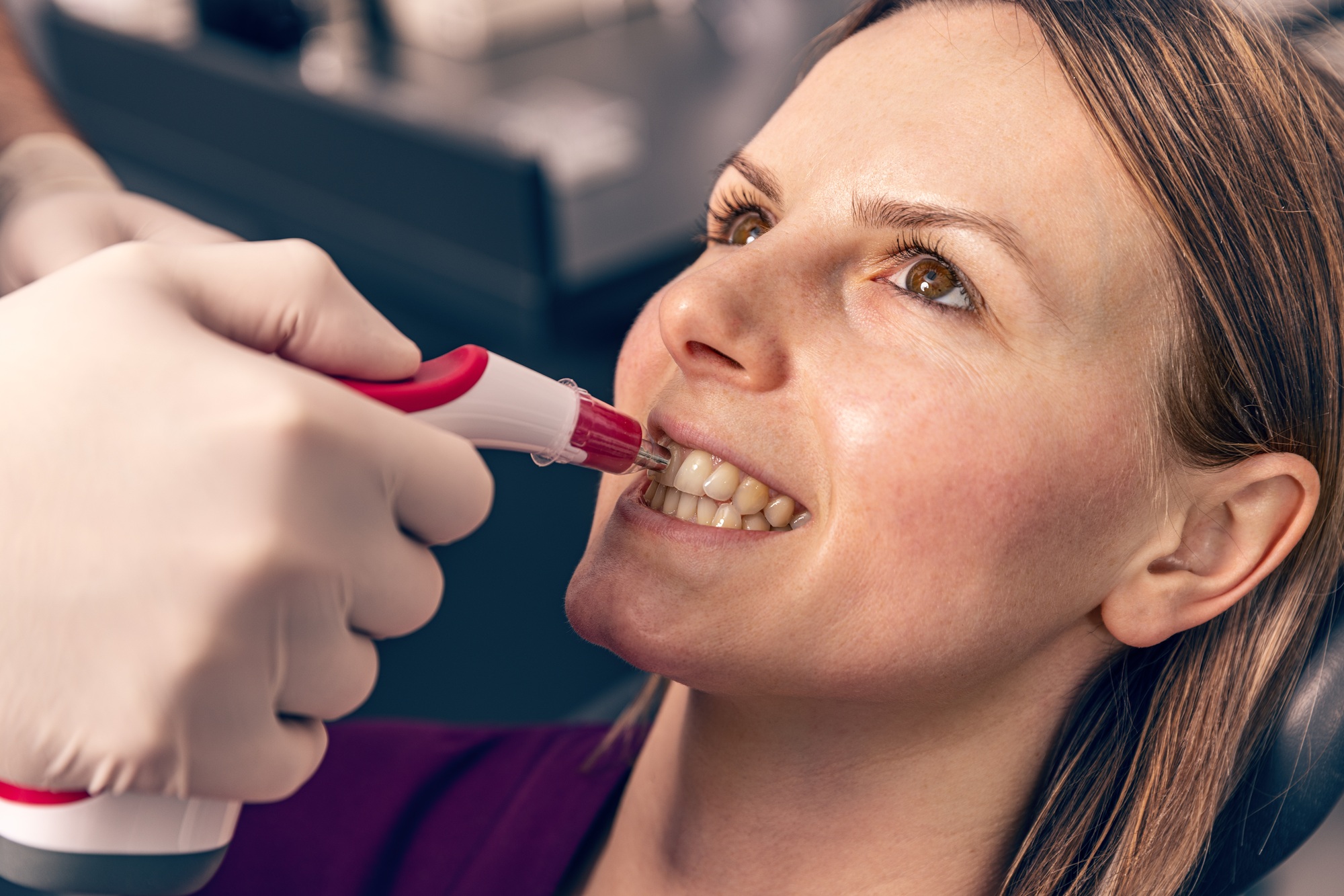 Teeth whitening concept