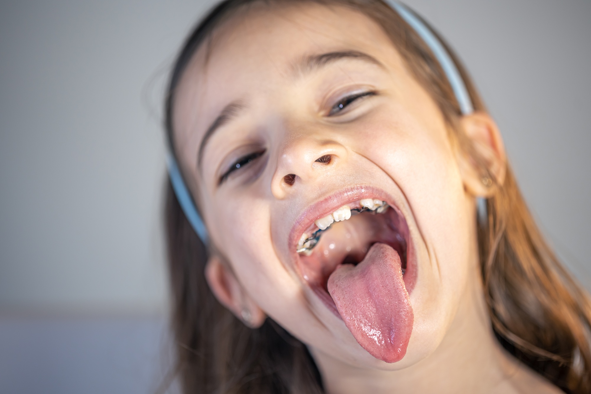 A child girl open her mouth and show her tounge.
