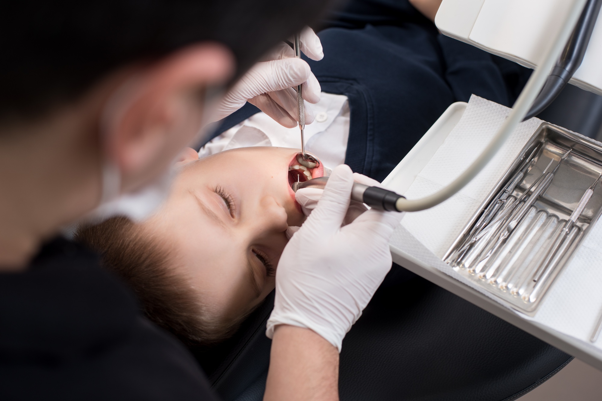 Boy with open mouth during drilling treatment at the pediatric dentist in dental clinic