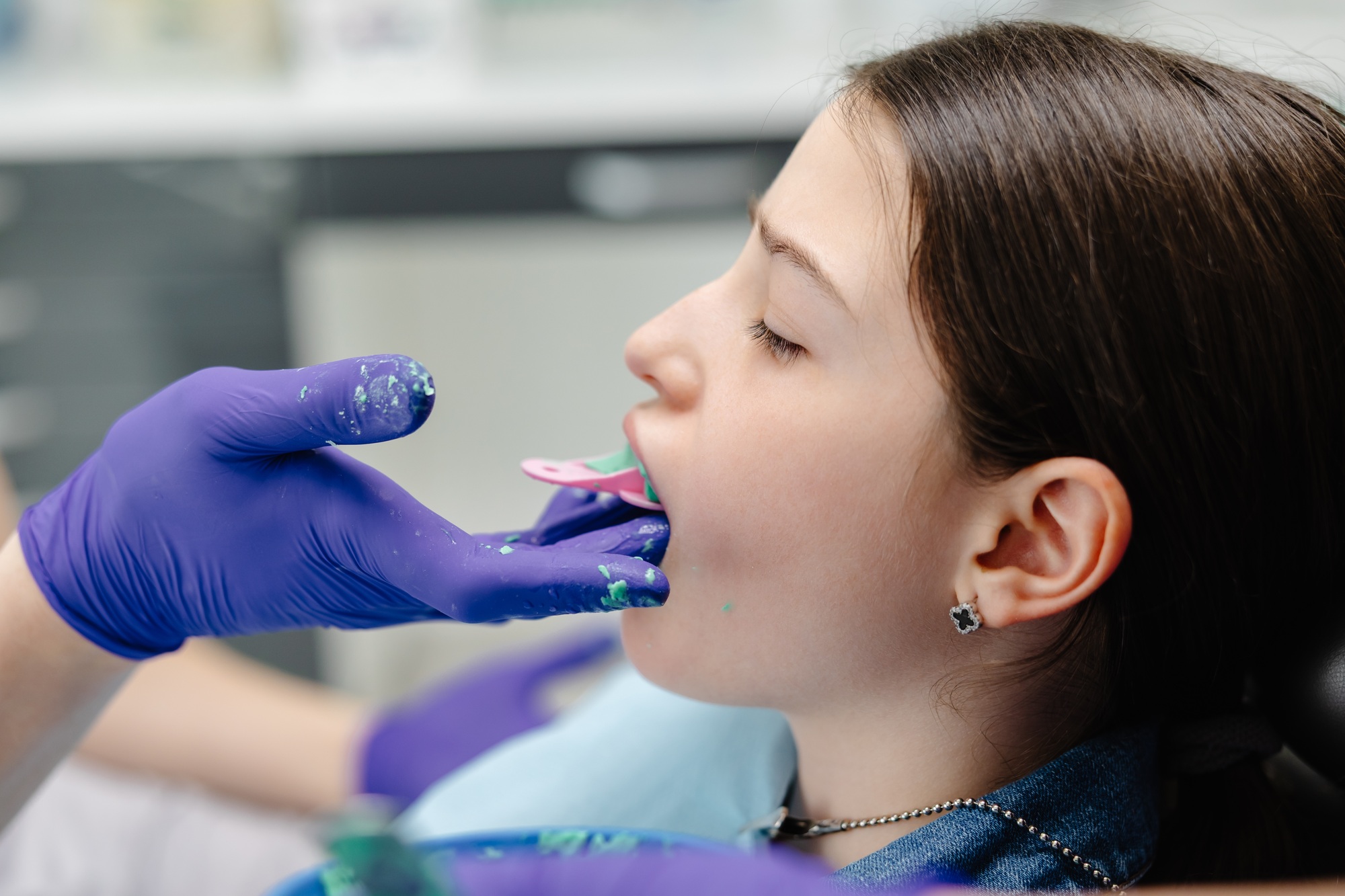 Dentist applying dental sealant on teeth of teenage girl