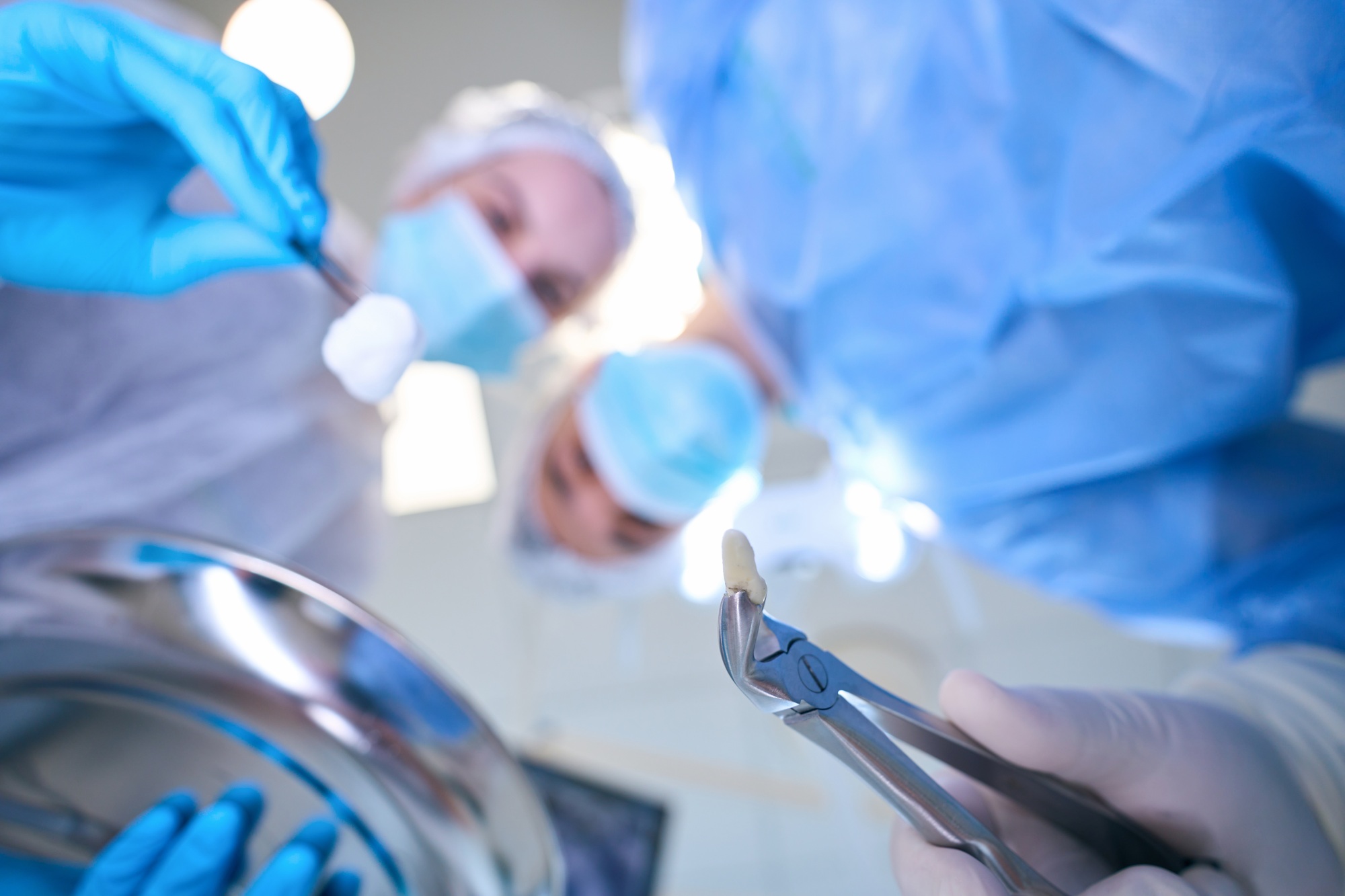 Male surgeon holds forceps with tooth removed in his hands