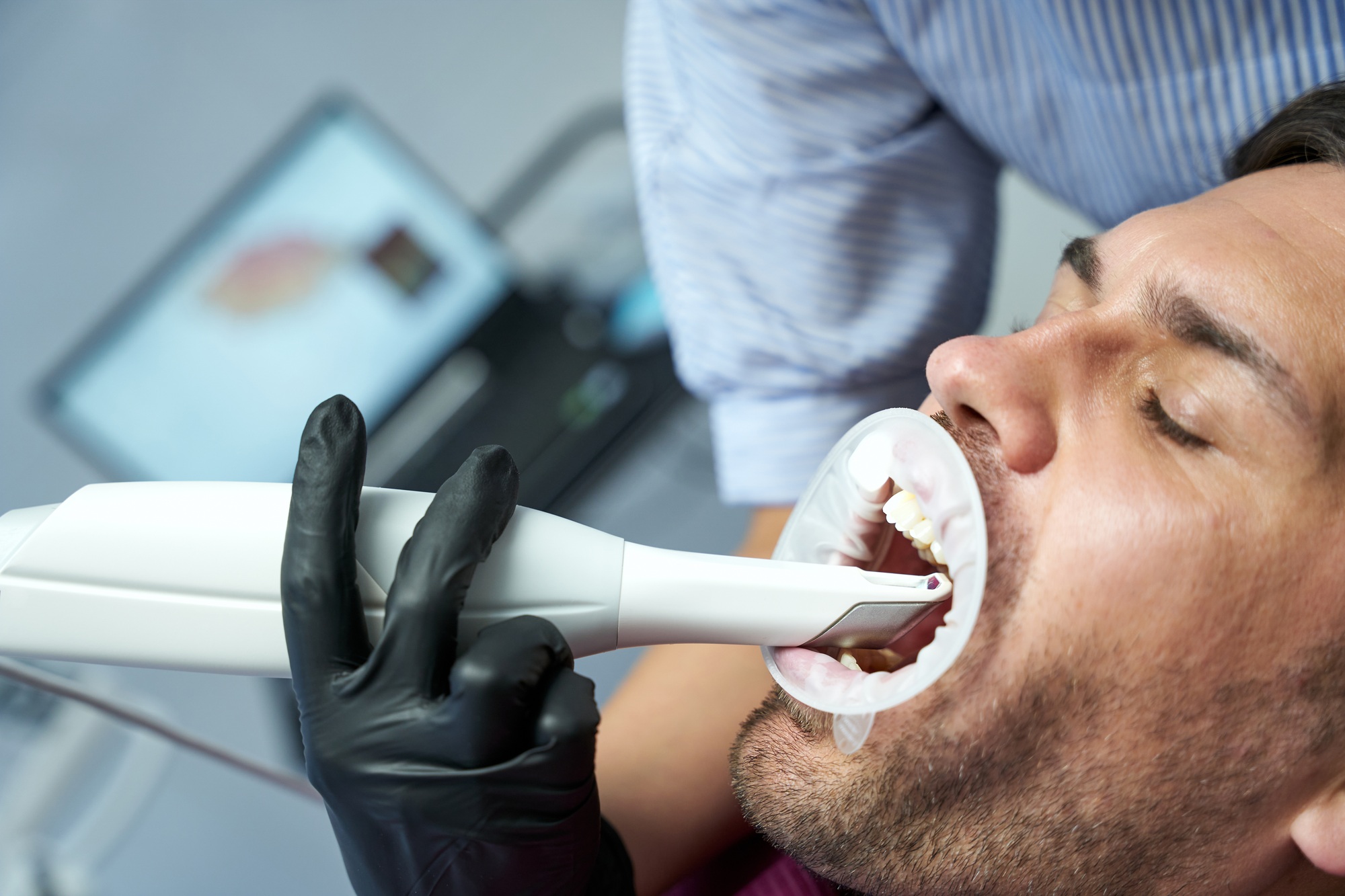Patient of dental clinic having teeth cured with special laser