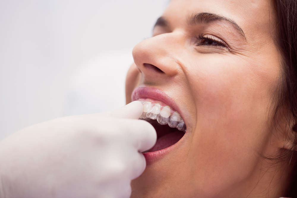 Straighten Your Teeth Discreetly with Invisalign in Lawrenceville