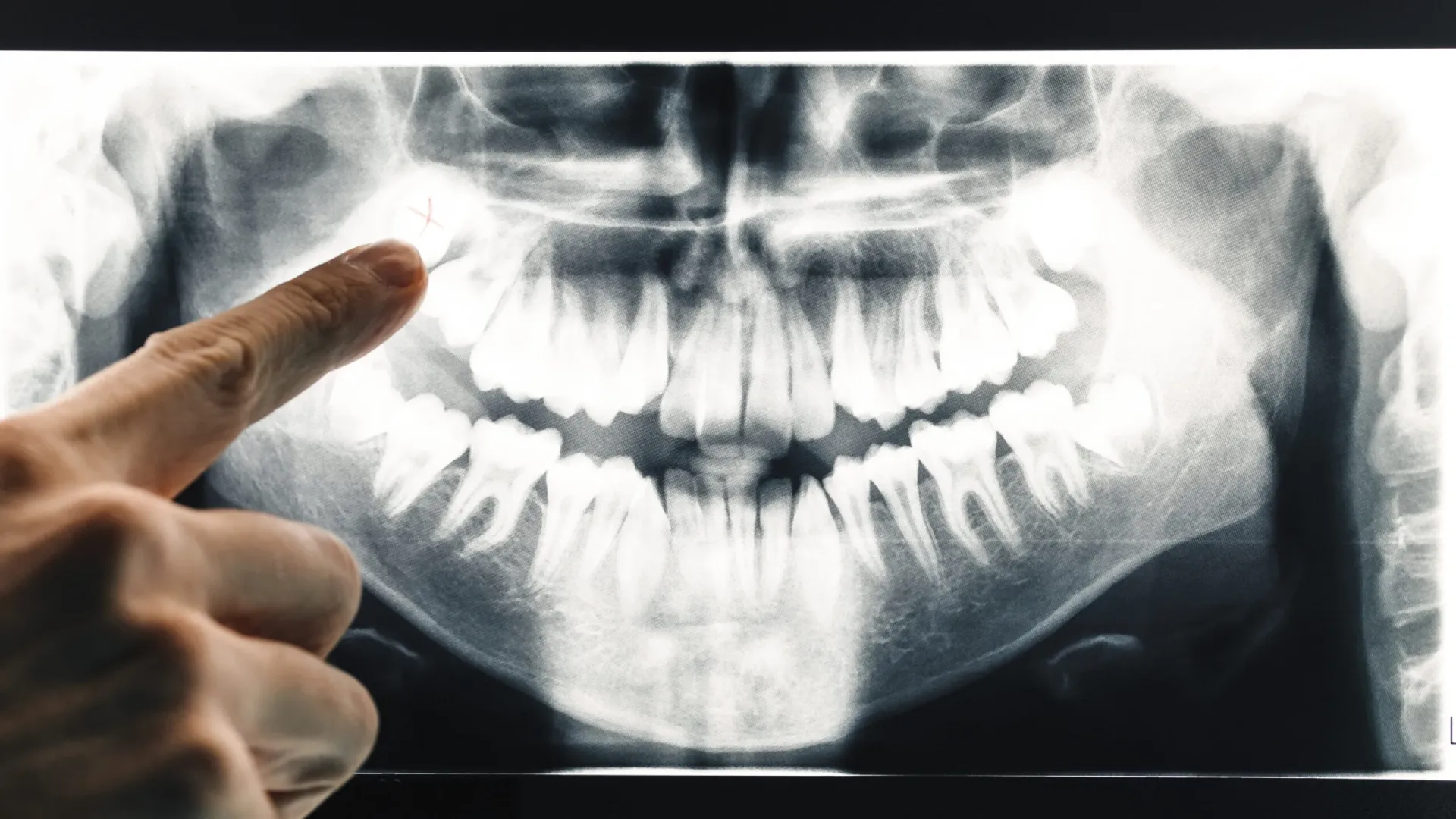 dentist-hand-points-to-teeth-in-x-ray-2025-01-29-03-11-55-utc-scaled (1)