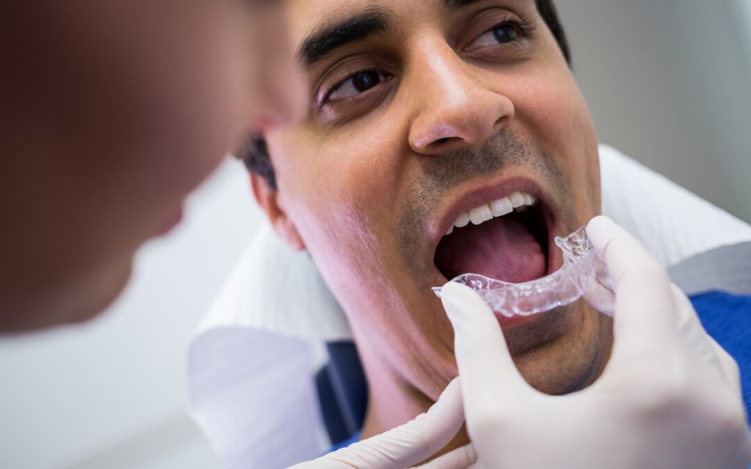 Bright Smiles helping you find the best fit