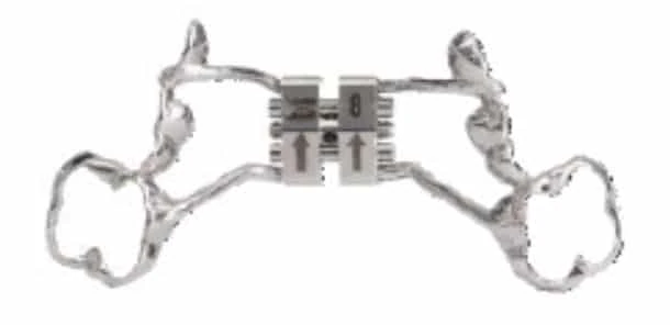 Vivos PEx pediatric expansion appliance with central expansion mechanism